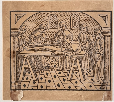 medieval_anatomy_woodcut_from_a_lyon_edition_circa_1500