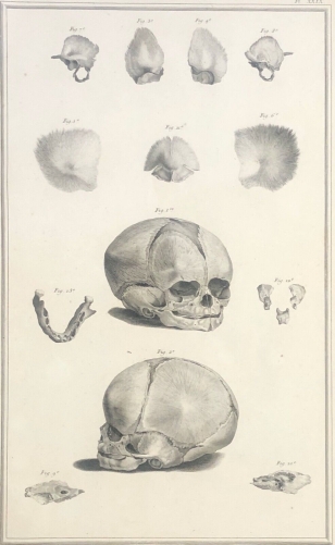 formation_occipital_machoire_1759_dapres_tarsis_osteologie_medecine