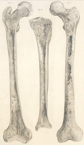 femur_droit_tete_femur_tibia_1759_dapres_tarsis_osteologie_anatomie_medecine
