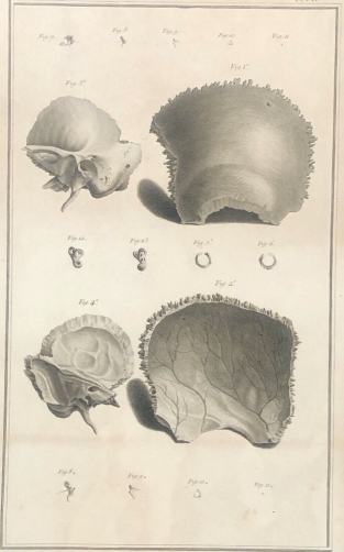 parietaux_et_temporaux_1759_dapres_tarsis_osteologie