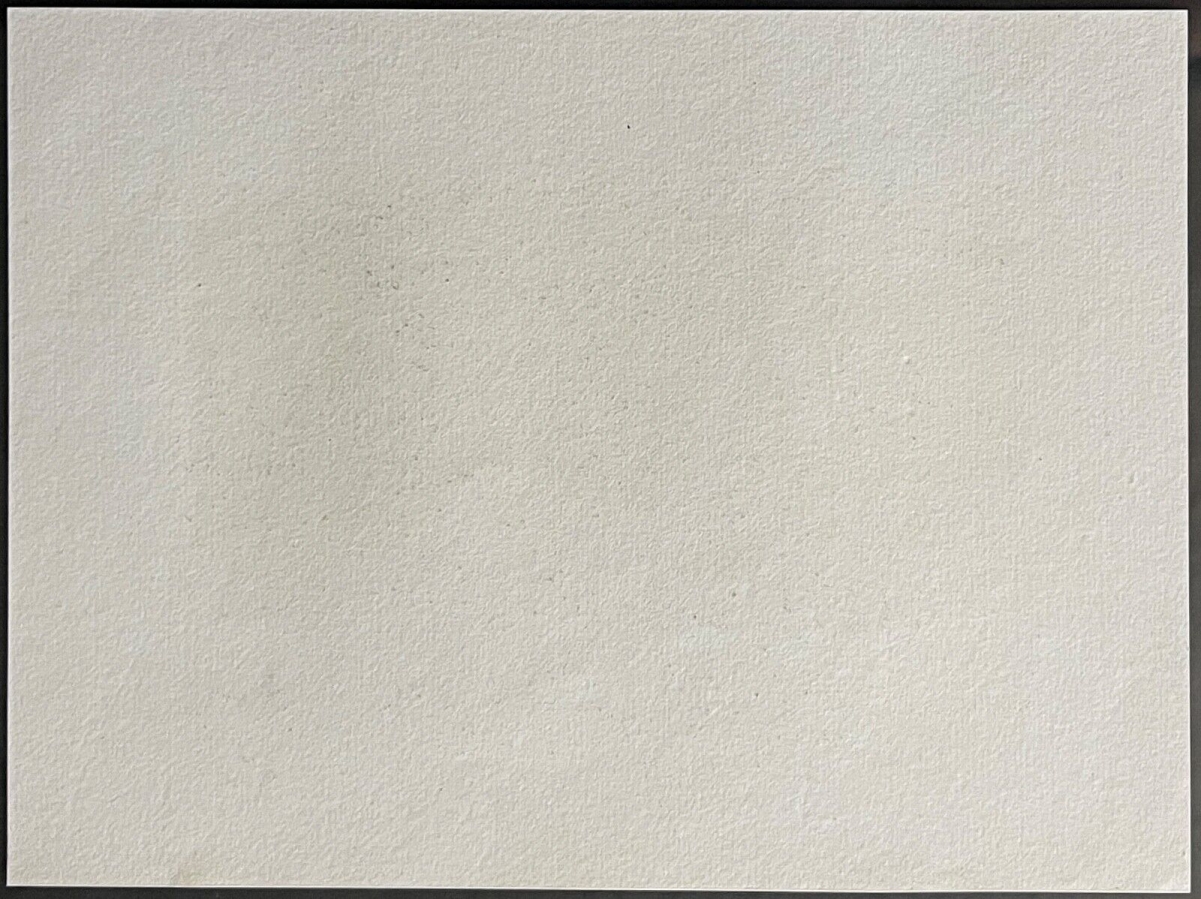 napoleon_bonaparte_blesse_au_pied_devant_ratisbonne_1809_allemagne_regensburg